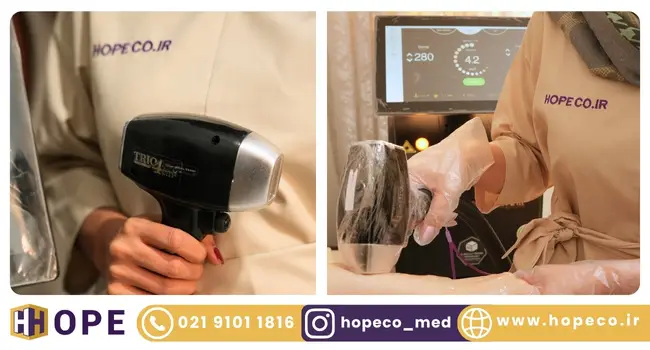 بهترین دستگاه لیزر مو