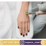 موارد منع لیزر موهای زائد