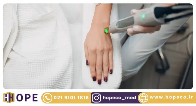 موارد منع لیزر موهای زائد