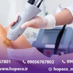 موارد منع لیزر موهای زائد