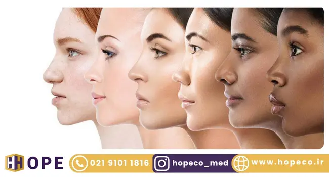 نوع پوستی فیتزپاتریک چیست؟