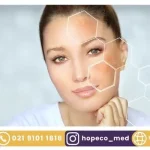 درمان لک صورت با لیزر کیوسوییچ