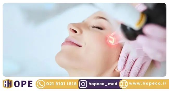 کاربردهای لیزر co2 فرکشنال