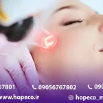 کاربردهای لیزر co2 فرکشنال